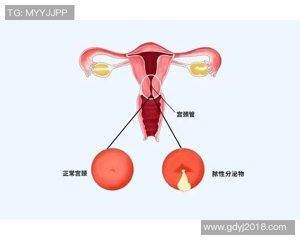 通过科学训练方法提升蛙泳技巧和速度的全面指南